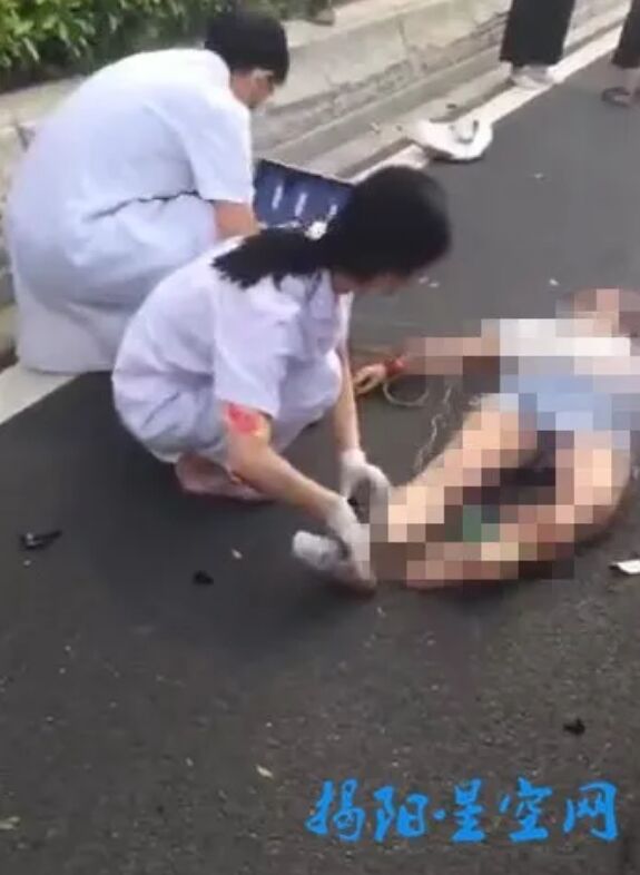 潮州：潮安大道轿车碾压摩托车，伤者被盖上蓝布，女司机一脸淡定！