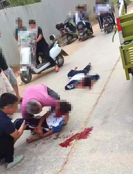 普宁市高埔镇梅坪路2名学生在这个路段被撞，满地鲜血