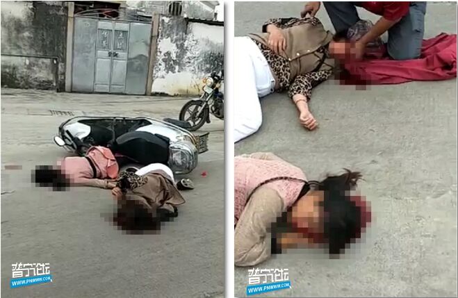 事故！普宁下架山百吉岭村这地方一起车辆碰撞，两女子头部受伤流血不止